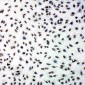 Anti-PERK Antibody